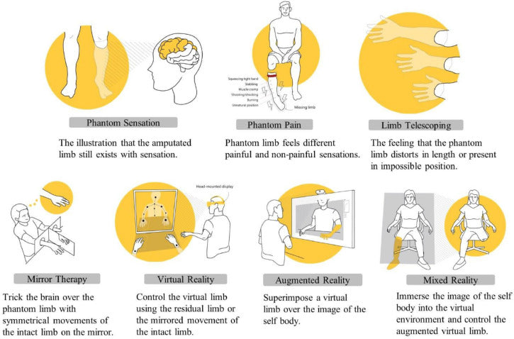 Mirror Therapy Exercises for Phantom Limb Pain